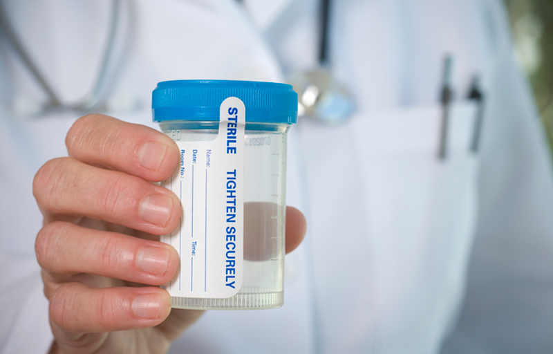 Are Doctors Drug Tested?