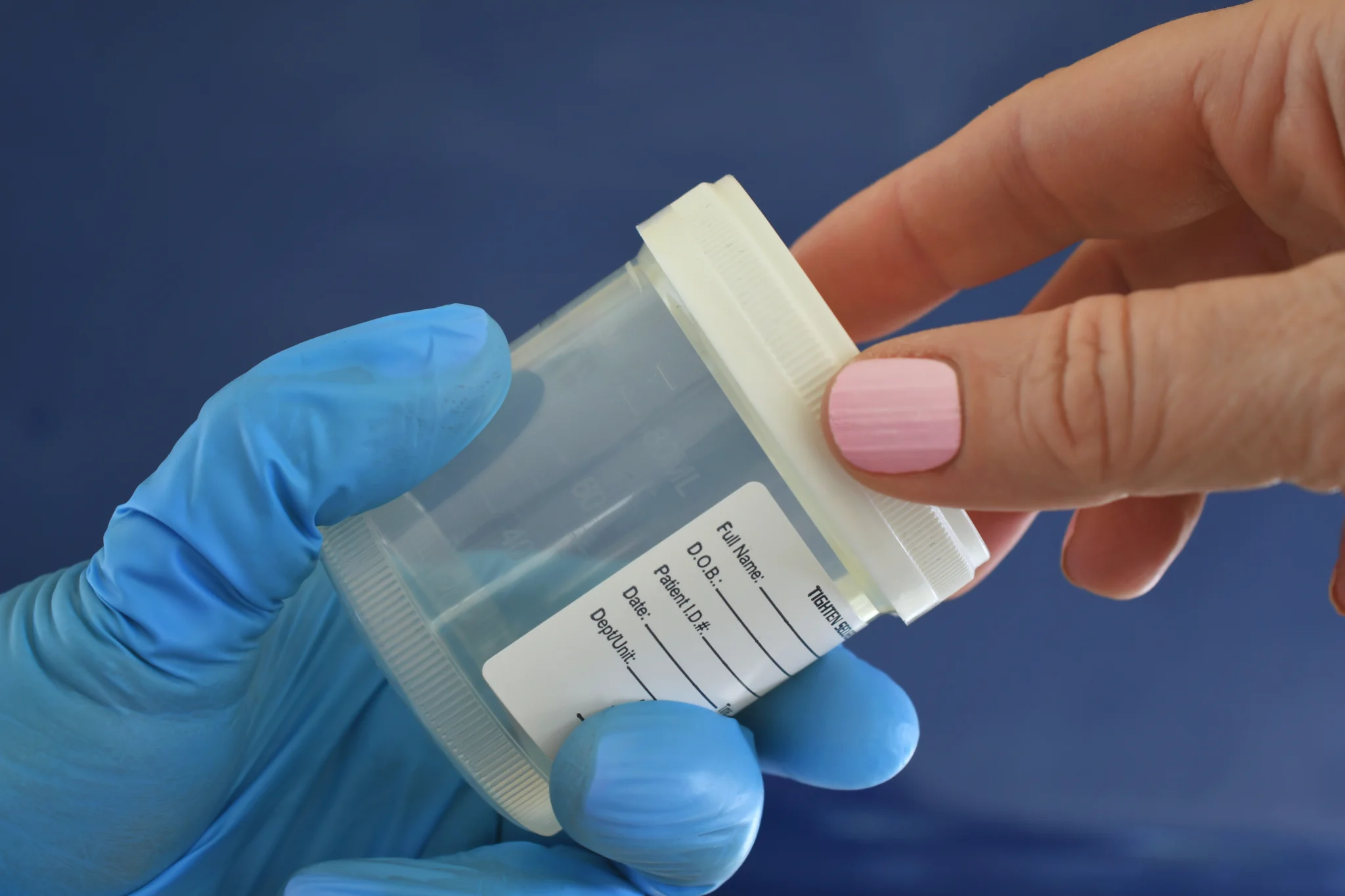 medical doctor nurse handing patient urine drug test